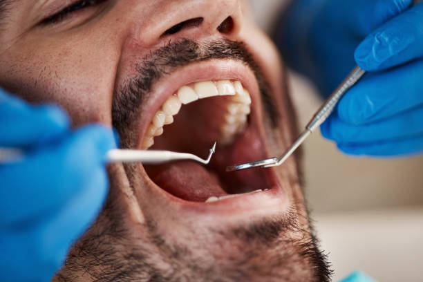 Best Emergency Denture Repair in University Heights, OH