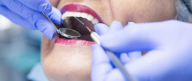 Best Emergency Orthodontic Services in University Heights, OH